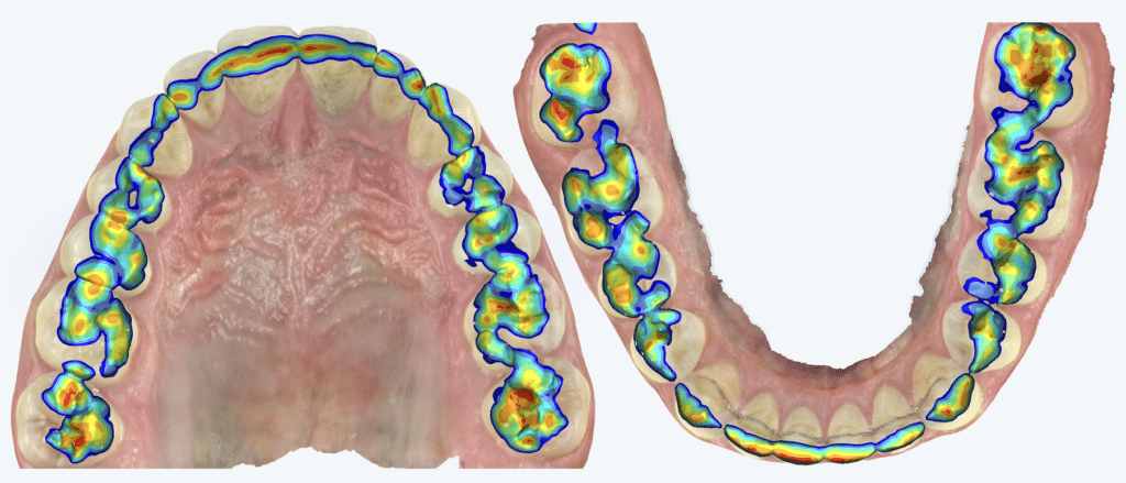 Occlusal Analysis